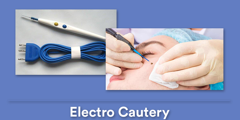 electro-cautery