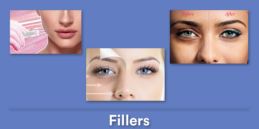 fillers