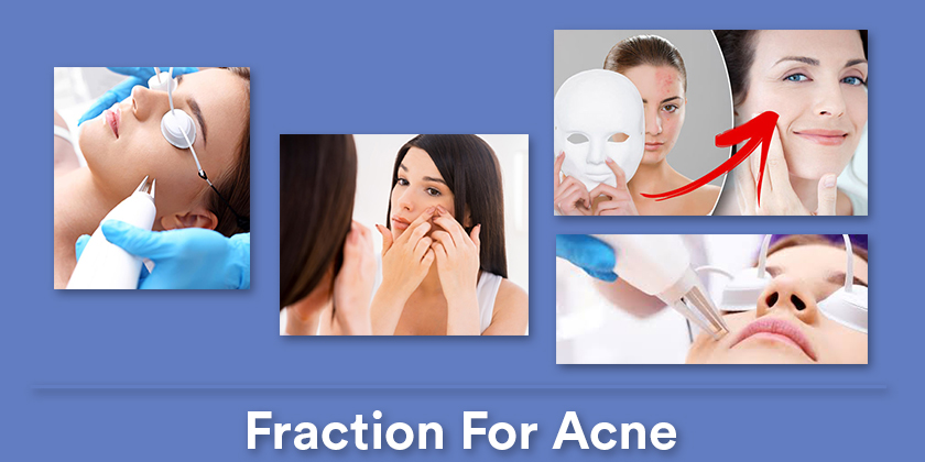 fraction-for-acne