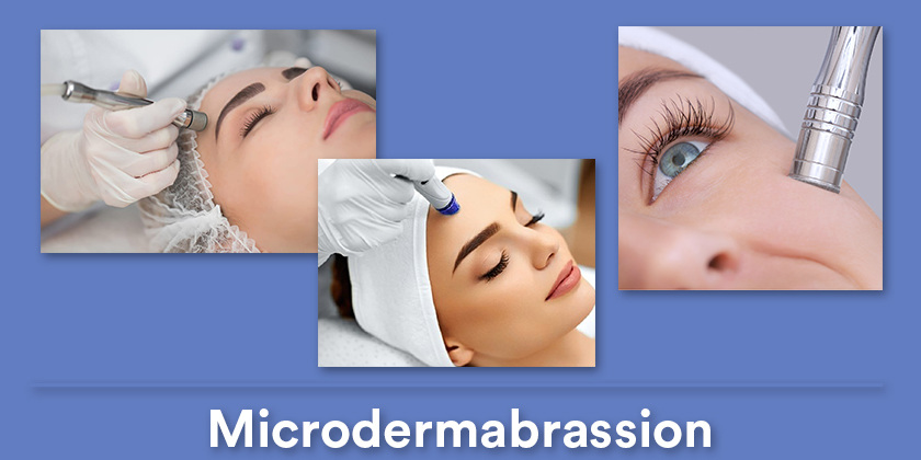 microdermabrassion
