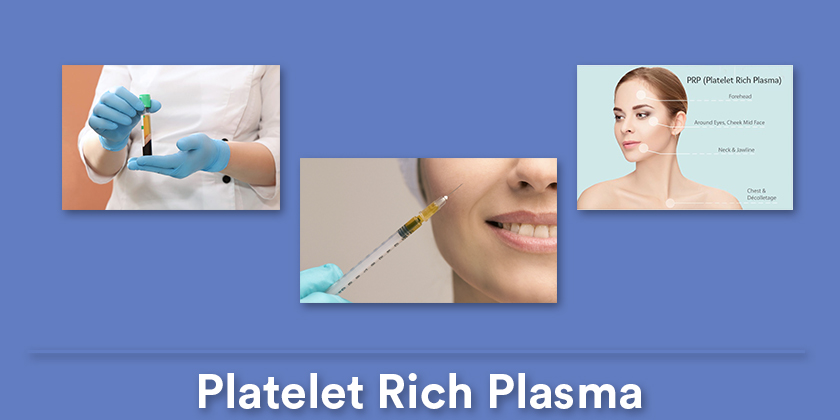 platelet-rich-plasma