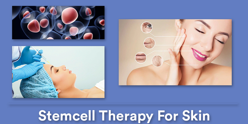 stemcell-therapy-for-skin